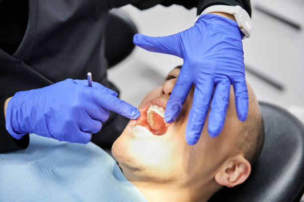 Best Emergency Treatment for Dental Infections or Abscesses in Tool, TX