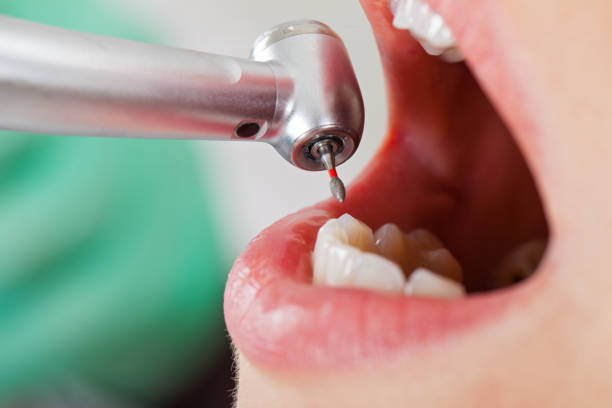 Best After-Hours Dental Trauma Care in Tool, TX
